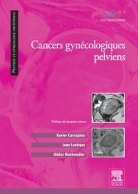 Cancers gynécologiques pelviens