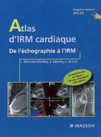 Atlas d'IRM cardiaque : de l'échographie à l'IRM