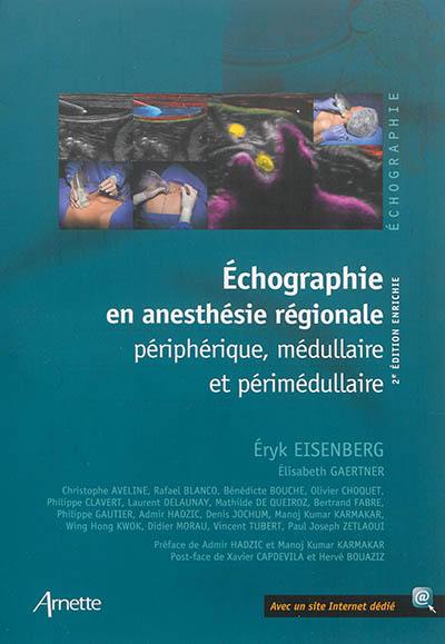 Echographie en anesthésie régionale périphérique, médullaire et périmédullaire