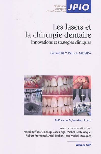 Les lasers et la chirurgie dentaire : innovations et stratégies cliniques