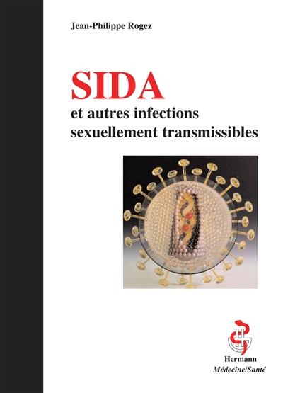 Sida et autres infections sexuellement transmissibles