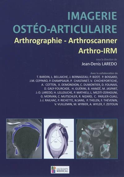 Imagerie ostéo-articulaire : arthrographie, arthroscanner, arthro-IRM