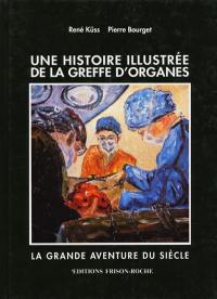 Une histoire illustrée de la greffe d'organes : la grande aventure du siècle