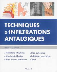 Techniques d'infiltrations antalgiques