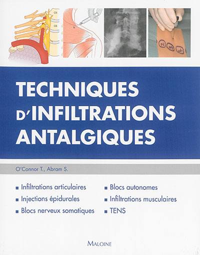 Techniques d'infiltrations antalgiques