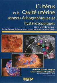 L'utérus et la cavité utérine : aspects échographiques et hystéroscopiques