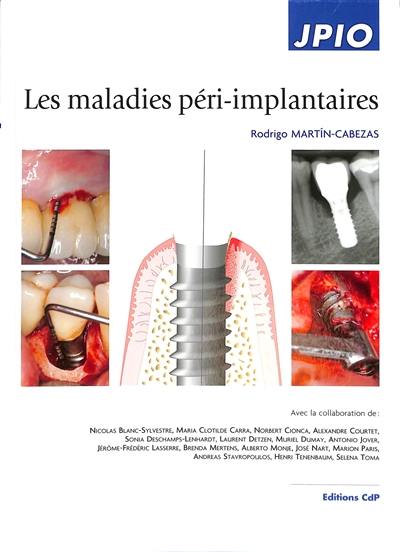 Les maladies péri-implantaires