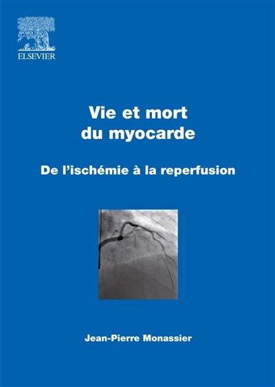 Vie et mort du myocarde : de l'ischémie à la reperfusion