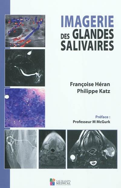 Imagerie des glandes salivaires