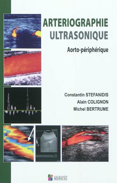 Artériographie ultrasonique : aorto-périphérique