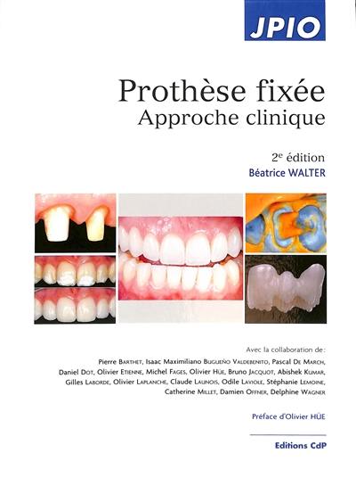 Prothèse fixée : approche clinique