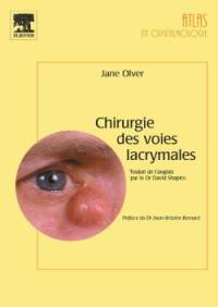 Chirurgie des voies lacrymales