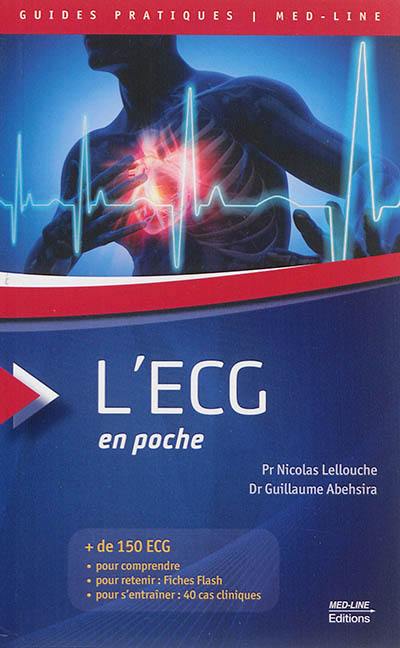 L'ECG en poche