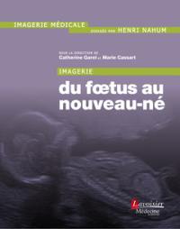 Imagerie du foetus au nouveau-né