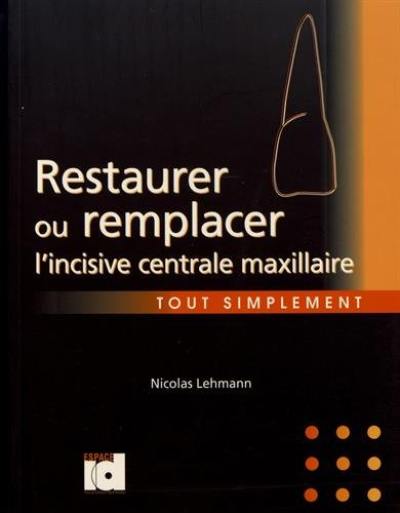 Restaurer ou remplacer l'incisive centrale maxillaire