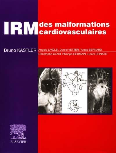 IRM des malformations cardiovasculaires