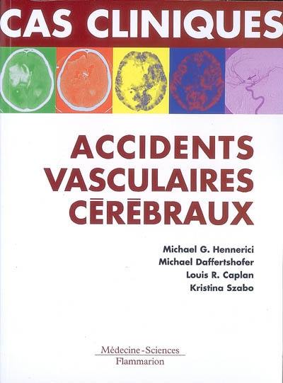 Accidents vasculaires cérébraux : formes cliniques habituelles et inhabituelles