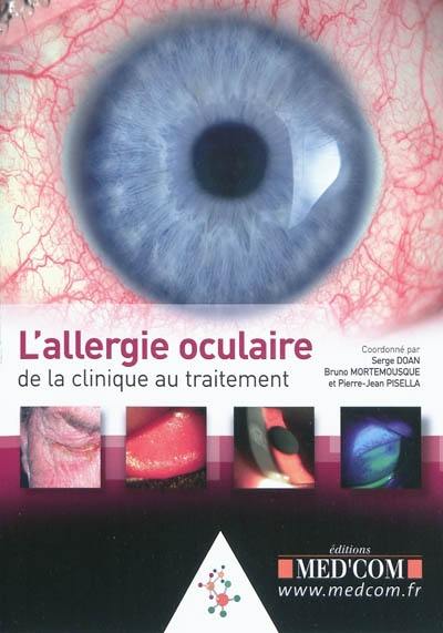 L'allergie oculaire : de la clinique au traitement