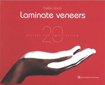 Laminate veneers : 20 recipes for smile design