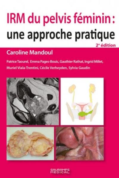 IRM du pelvis féminin : une approche pratique IRM du pelvis féminin : une approche pratique