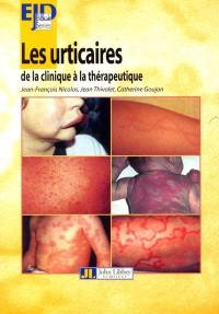 Les urticaires : de la clinique à la thérapeutique