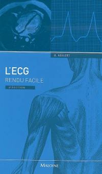 L'ECG rendu facile