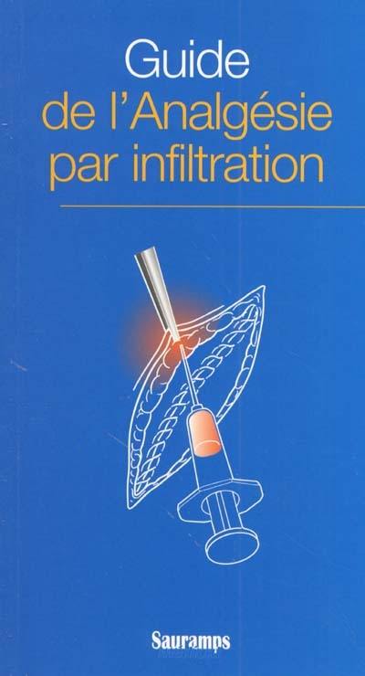 Guide de l'analgésie par infiltration