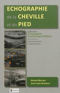 Echographie de la cheville et du pied