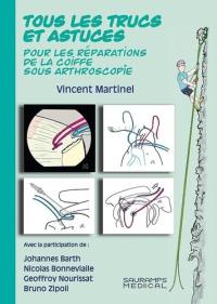 Tous les trucs et astuces : pour les réparations de la coiffe sous arthroscopie