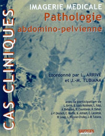 Imagerie médicale : pathologie abdomino-pelvienne