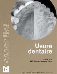 Usure dentaire