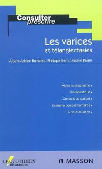 Les varices et télangiectasies : aides au diagnostic, thérapeutique, conseils au patient, examens complémentaires, auto-évaluation