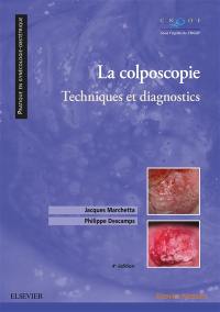 La colposcopie : technique et diagnostics