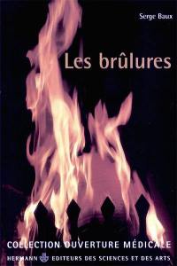 Les brûlures