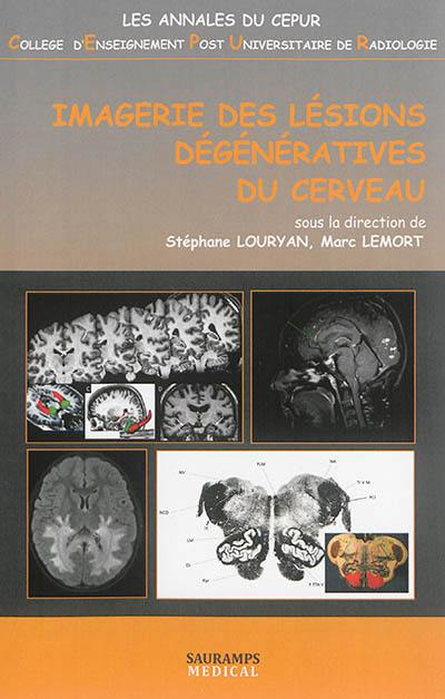 Imagerie des lésions dégénératives du cerveau