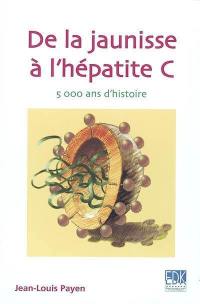 De la jaunisse à l'hépatite C, 5000 ans d'histoire