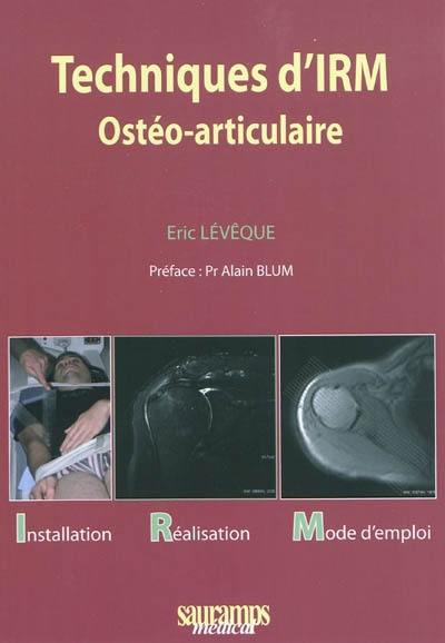 Techniques d'IRM ostéo-articulaire : installation, réalisation, mode d'emploi