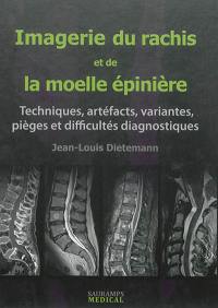 Imagerie du rachis et de la moelle épinière : techniques, artéfacts, variantes, pièges et difficultés diagnostiques