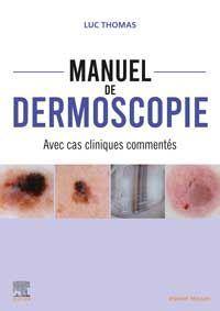 Manuel de dermoscopie : avec cas cliniques commentés