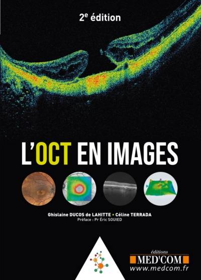 L'OCT en images