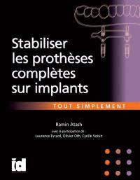 Stabiliser les prothèses complètes sur implants