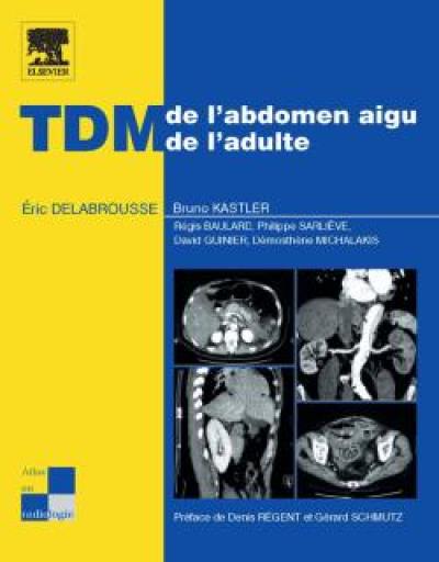 TDM de l'abdomen aigu de l'adulte