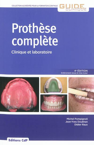 Prothèse complète : clinique et laboratoire