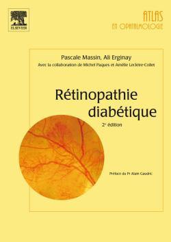 Rétinopathie diabétique