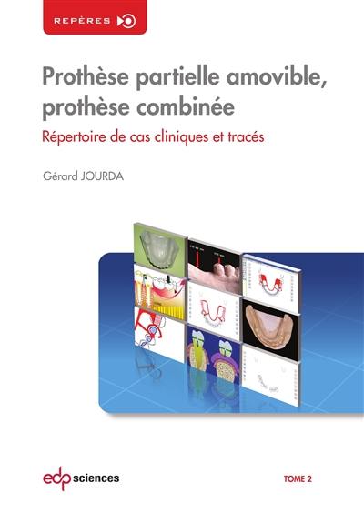 Prothèse partielle amovible, prothèse combinée : répertoire de cas cliniques et tracés