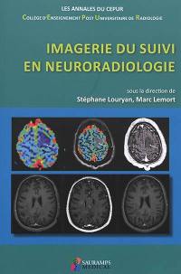 Imagerie du suivi en neuroradiologie