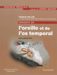 Imagerie de l'oreille et de l'os temporal. Vol. 2. Inflammation