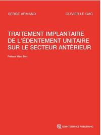 Traitement implantaire de l'édentement unitaire sur le secteur antérieur