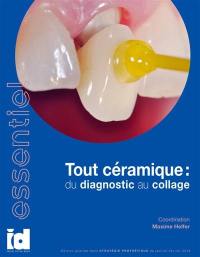 Tout céramique : du diagnostic au collage