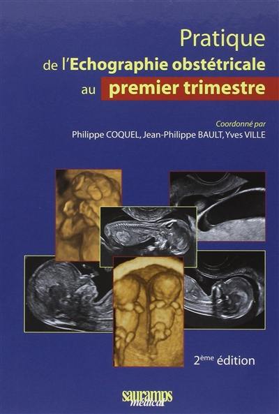 Pratique de l'échographie obstétricale